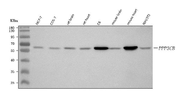 PPP3CB Rabbit Polyclonal Antibody