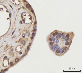 NEIL3 Rabbit Polyclonal Antibody