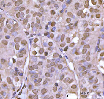 NEIL3 Rabbit Polyclonal Antibody