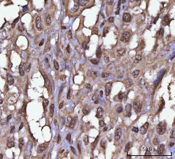 NEIL3 Rabbit Polyclonal Antibody