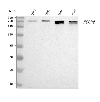 NCOR2 Rabbit Polyclonal Antibody