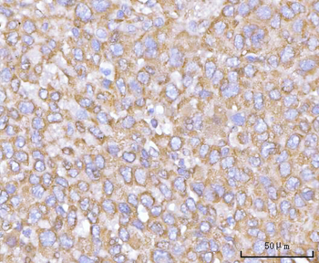 NANP Rabbit Polyclonal Antibody