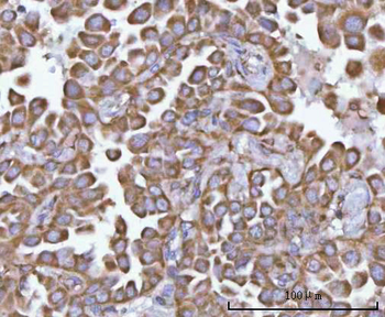 NANP Rabbit Polyclonal Antibody