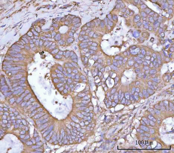 NANP Rabbit Polyclonal Antibody