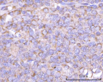 NANP Rabbit Polyclonal Antibody