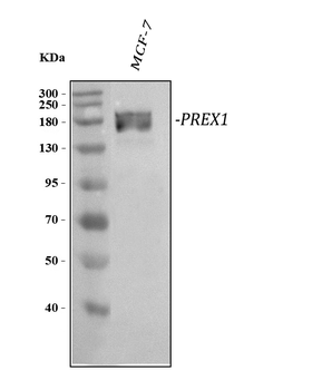 PREX1 Rabbit Polyclonal Antibody