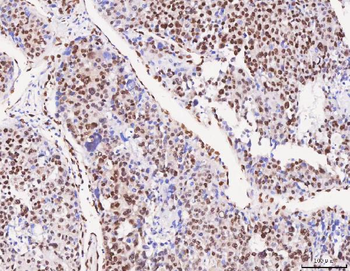 FOX2/RBM9/RBFOX2 Rabbit Polyclonal Antibody