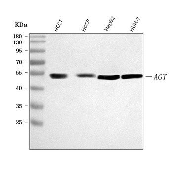 Angiotensinogen/AGT Rabbit Polyclonal Antibody