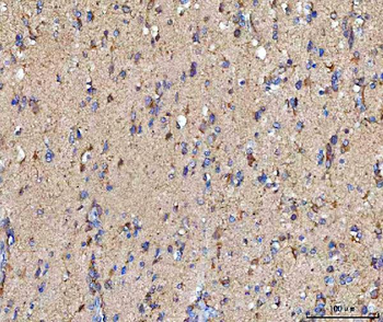 MOSPD2 Antibody
