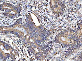 MOSPD2 Antibody