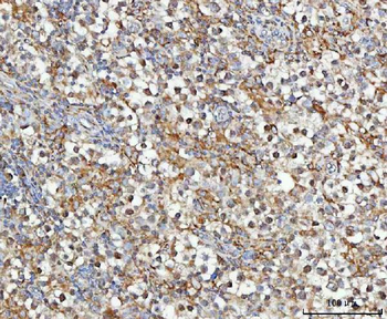 MOSPD2 Antibody