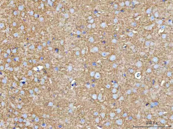 MOSPD2 Antibody