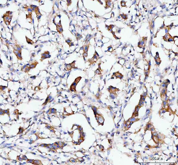 MOGAT2 Antibody