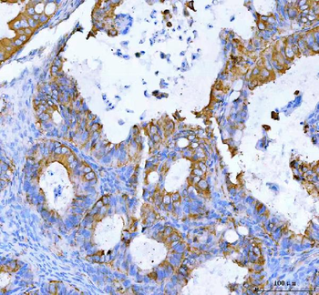 MOGAT2 Antibody