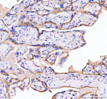 MOGAT2 Antibody
