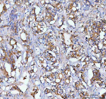 MOGAT2 Antibody