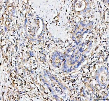 MOGAT2 Antibody