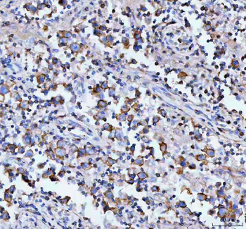 MOGAT2 Antibody