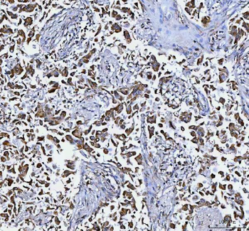 DAPK1 Rabbit Polyclonal Antibody