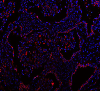 MLST8 Antibody