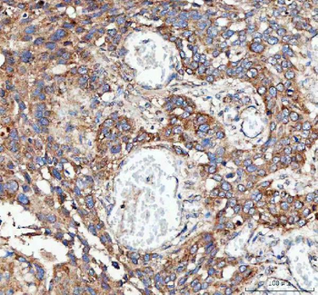 MLST8 Antibody
