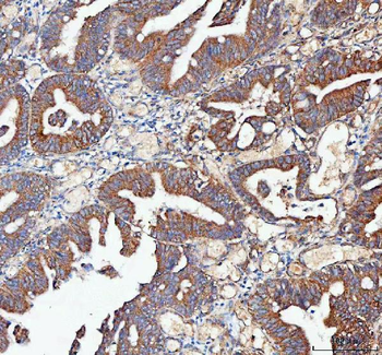 MLST8 Antibody