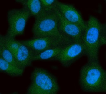 MPST Rabbit Polyclonal Antibody