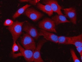 MELK Rabbit Polyclonal Antibody