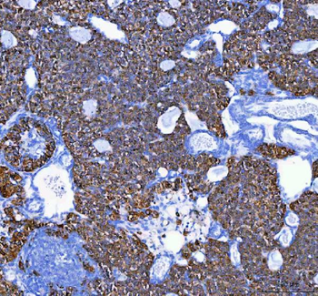 MELK Rabbit Polyclonal Antibody