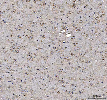 MAP1S Rabbit Polyclonal Antibody