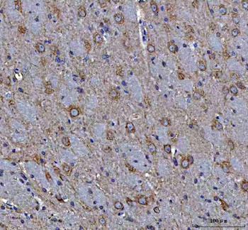 MAP1S Rabbit Polyclonal Antibody