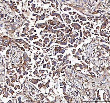 MCCC2 Rabbit Polyclonal Antibody