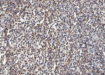 MCCC2 Rabbit Polyclonal Antibody