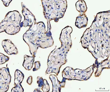 MCCC2 Rabbit Polyclonal Antibody