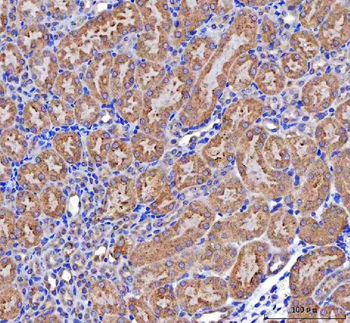 MCCC2 Rabbit Polyclonal Antibody