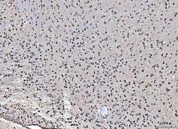 MATR3 Antibody