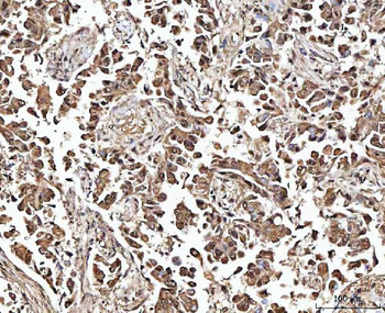 MATR3 Antibody