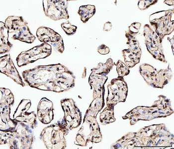 MATR3 Antibody