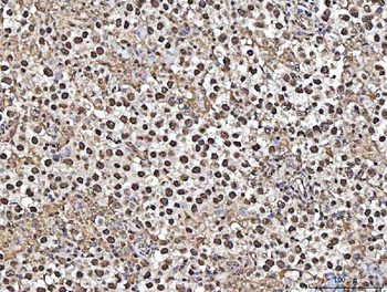 MATR3 Antibody