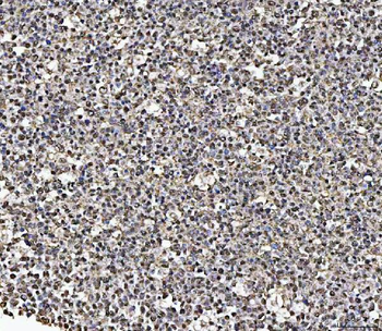 MATR3 Antibody