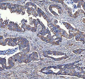 MTCL1 Antibody