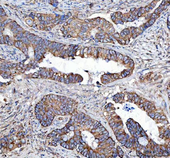 Malectin/MLEC Antibody