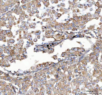 Malectin/MLEC Antibody