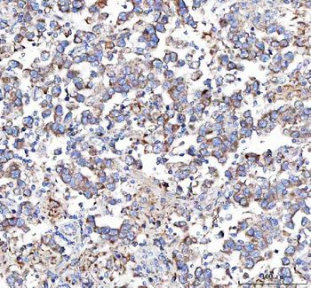 Malectin/MLEC Antibody
