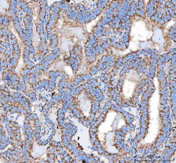 Malectin/MLEC Antibody