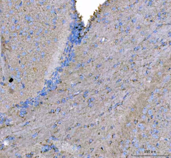 MAP6D1 Rabbit Polyclonal Antibody