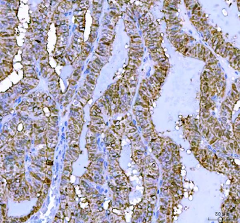 LHX6 Antibody