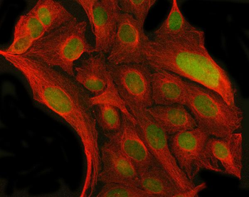 MYNN Rabbit Polyclonal Antibody