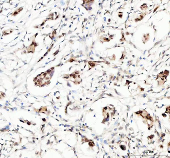 MYNN Rabbit Polyclonal Antibody