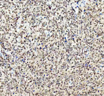 MYNN Rabbit Polyclonal Antibody